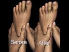 V4 Hands and Feet Fix Morphs