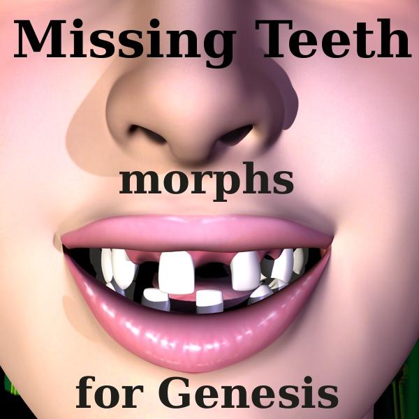 Missing Teeth Morphs for Genesis.