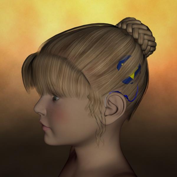 K4 Cochlear Implants