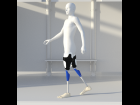 Modern computerized prosthetic legs for Genesis