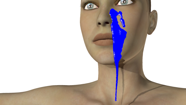 Blue Paint on V4 Face