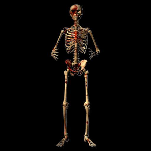 Bloody Bonez for Daz3d Bonez Skeleton