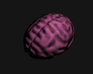 Brain